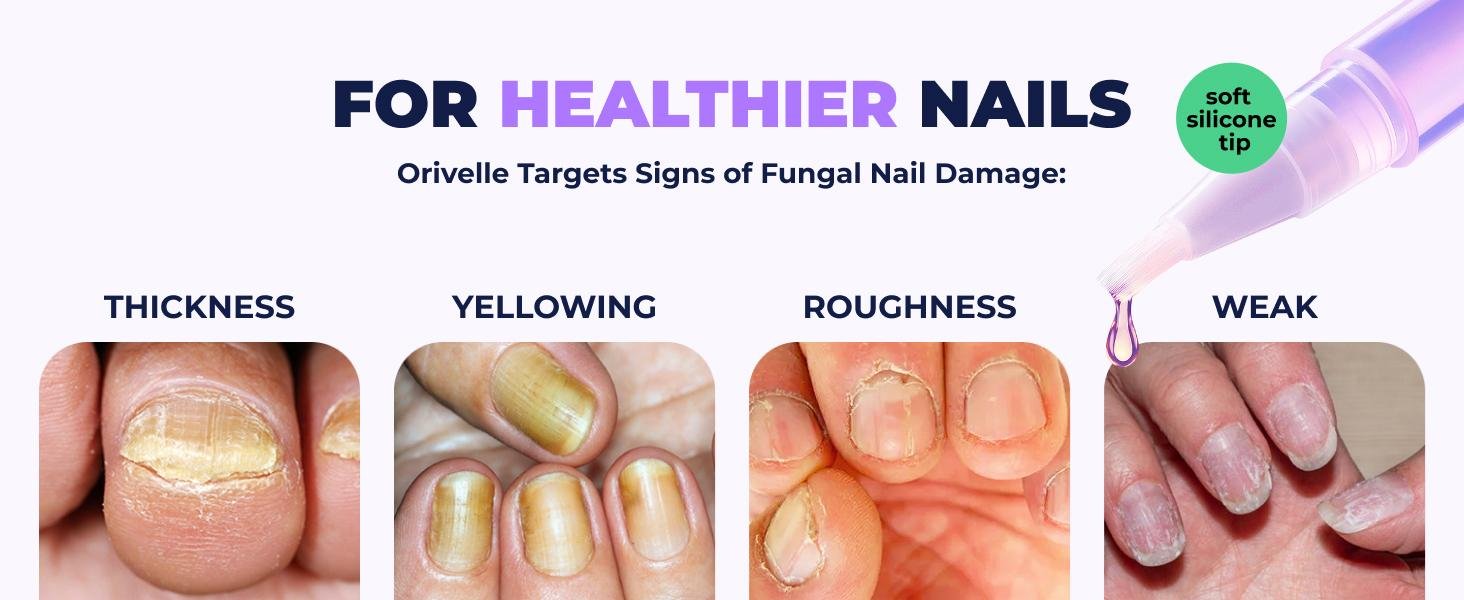 Orivelle Anti Fungus Pen