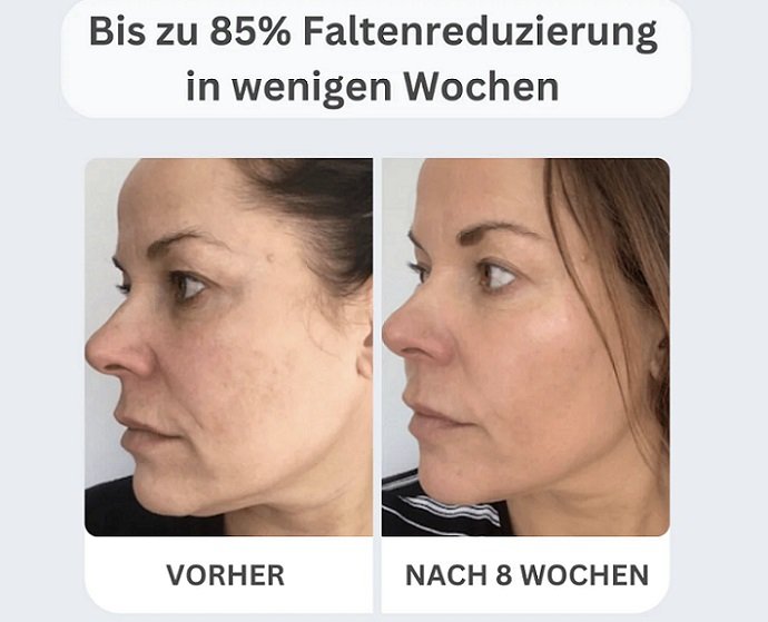 After Inject Serum 2