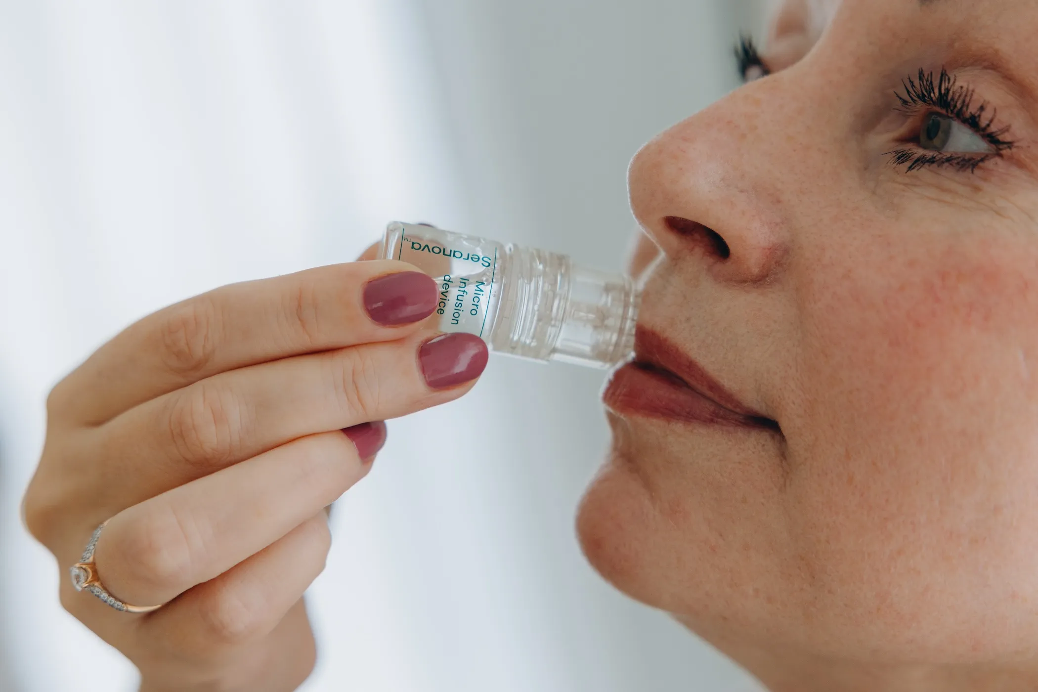 Seranova Micro Infusion Erfahrungen